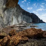 Vigea | Medicina Estética en Almería