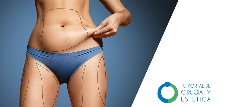 Tu Portal De Cirugía y Estética | CIRUGÍA ESTÉTICA EN ESPAÑA