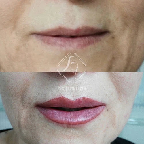 Estética Lorén